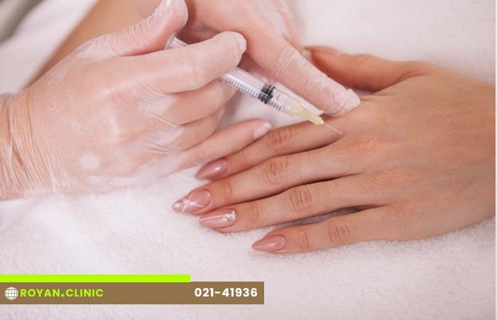 همه آنچه باید در مورد تزریق ژل و فیلر بدانید 11 تزریق ژل دست