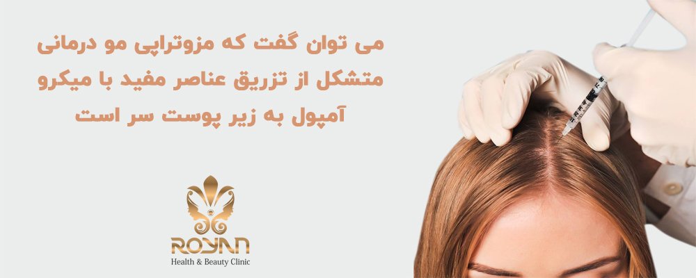 مزوتراپی برای ریزش مو
