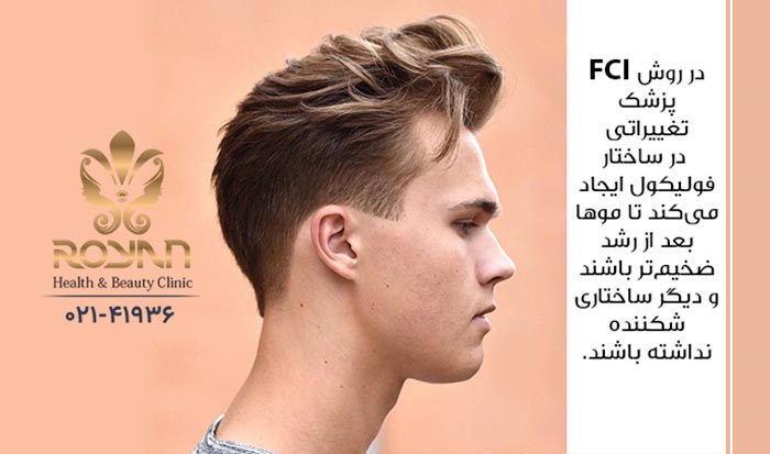 ویژگی کاشت مو به روش FCI