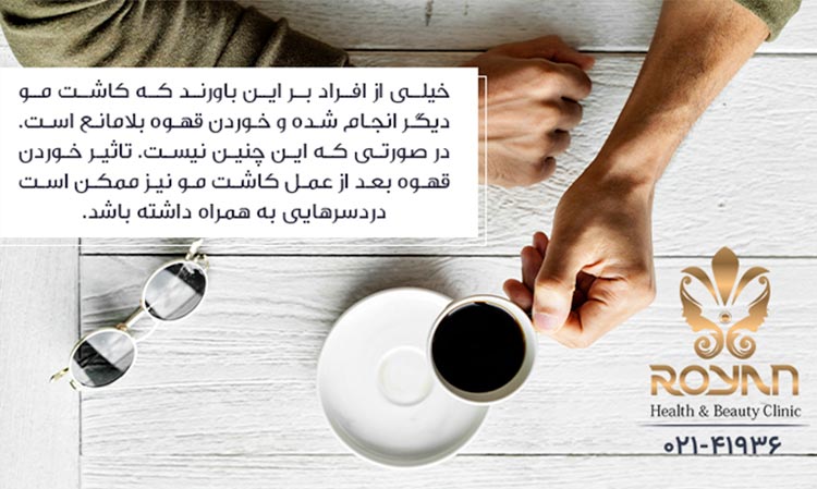 مصرف قهوه بعد از کاشت مو