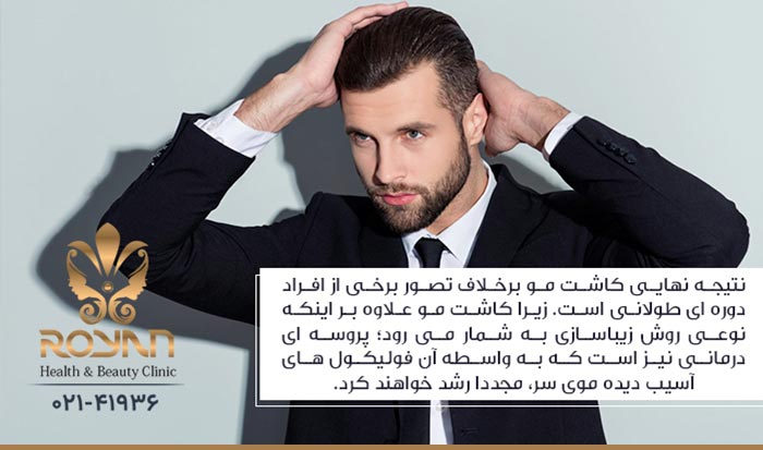 کاشت مو یک نوع درمان است