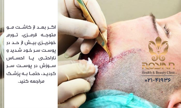 زمان مراجعه به پزشک بعد از عفونت