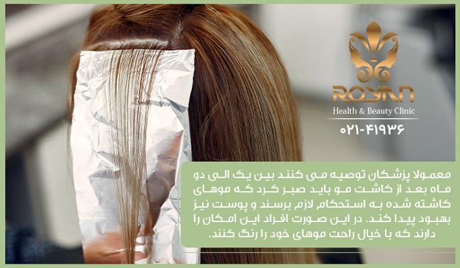 رنگ مو بعد از کاشت مو