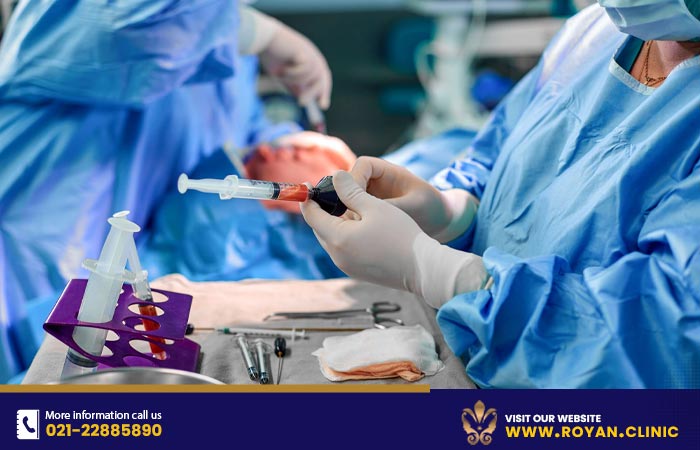 فرآیند تصفیه چربی