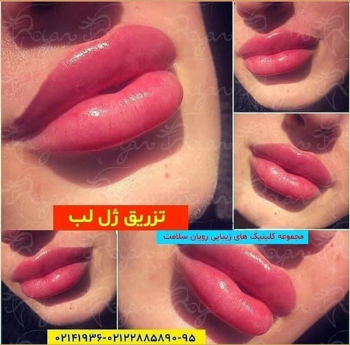 مدل ژل لب باربی