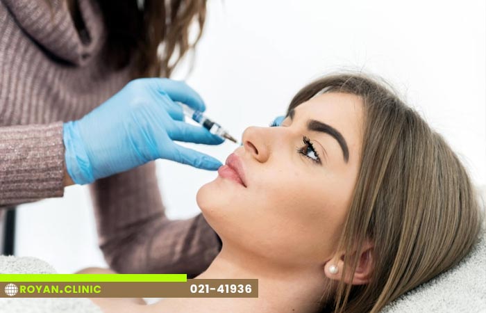 تزریق ژل زیر چشم