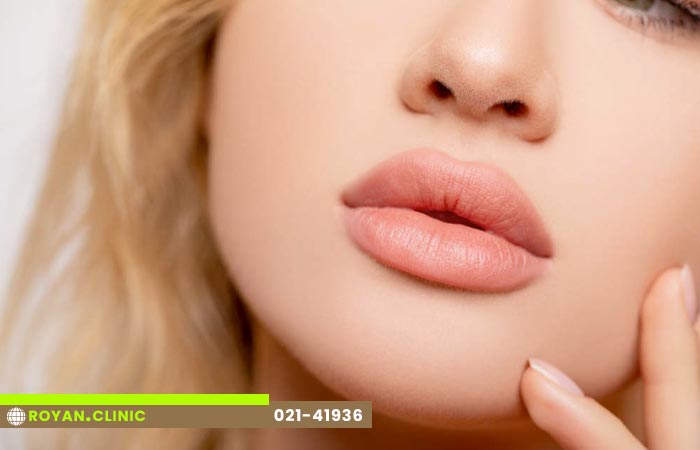 تزریق ژل لب نچرال
