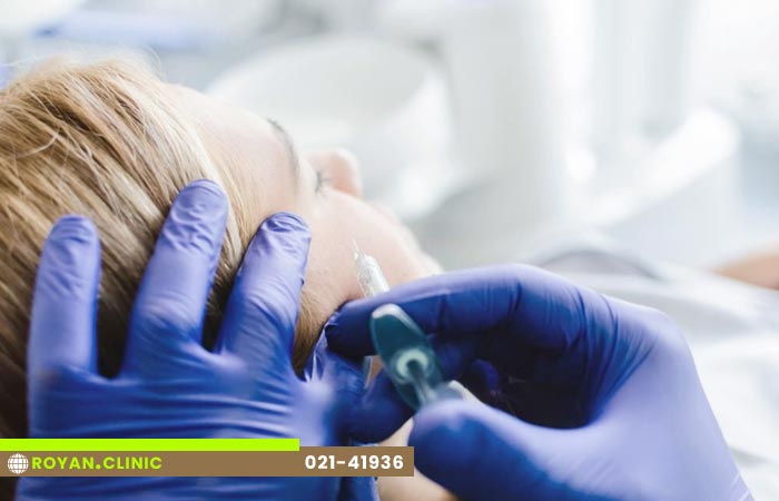 بوتاکس پنجه کلاغی