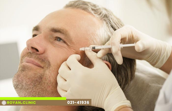 تزریق بوتاکس خطوط پنجه کلاغی