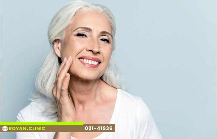 خط خنده در زنان مسن