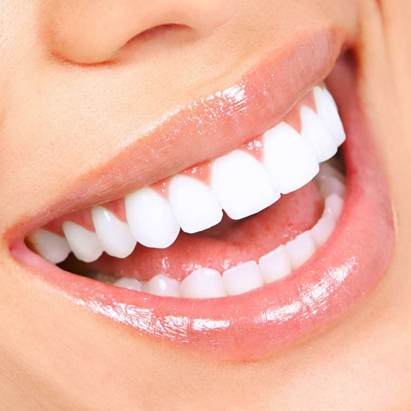 بوتاکس برای لثه و لبخند لثه ای چیست و چطور انجام می شود؟