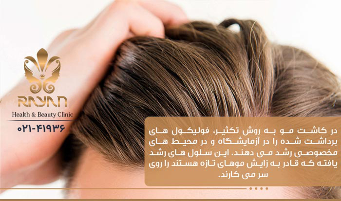 کاشت مو به روش تکثیر آزمایشگاهی