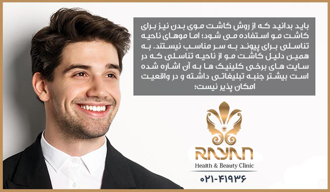 کاشت مو از بدن