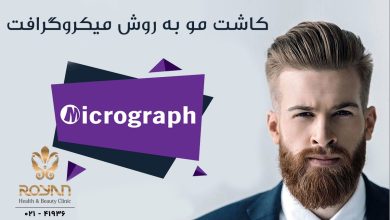 کاشت مو به روش میکروگرافت