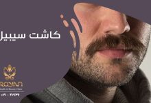 کاشت سیبیل