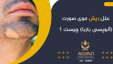 آلوپسی باربا