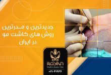 جدیدترین روش های کاشت مو