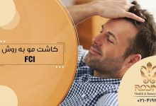 کاشت مو به روش FCI