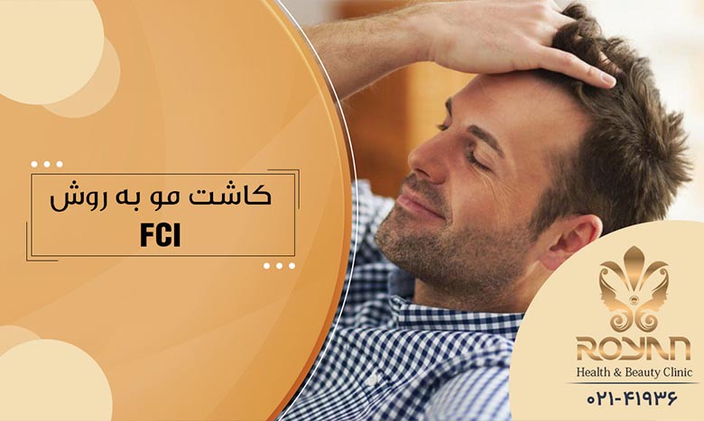 کاشت مو به روش FCI