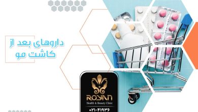 داروهای بعد از کاشت مو
