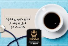 قهوه بعد از کاشت مو