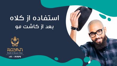 کلاه بعد از کاشت مو