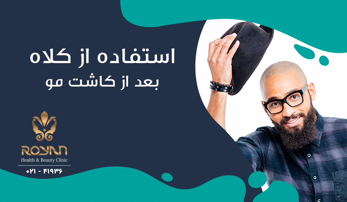 کلاه بعد از کاشت مو