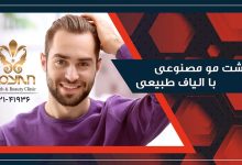 کاشت مو با الیاف نانو
