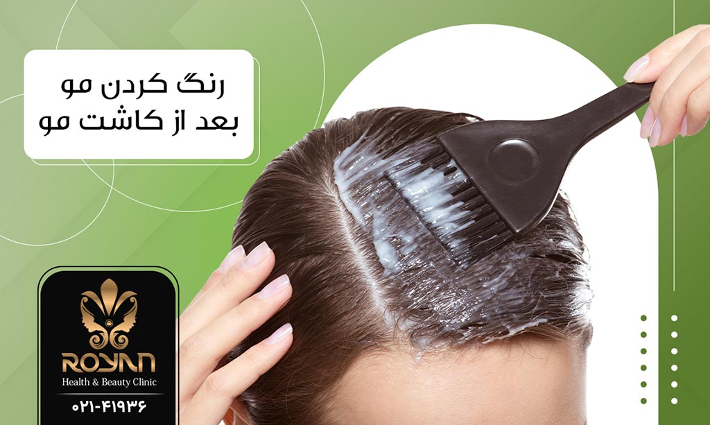 رنگ کردن موها بعد از کاشت مو