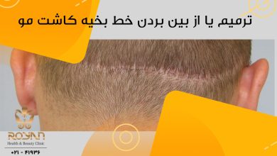 ترمیم خط بخیه بعد از کاشت مو