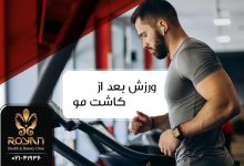 ورزش بعد از کاشت مو