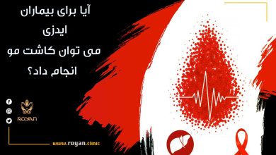 کاشت مو برای بیماران ایدزی