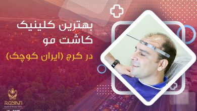 کلینیک کاشت موی کرج