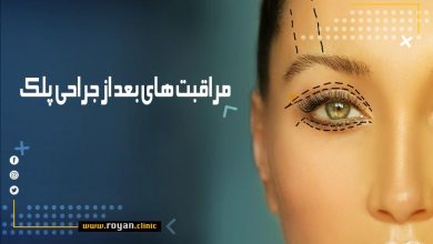 مراقبت های بعد از بلفاروپلاستی