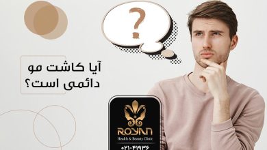 دائمی بودن کاشت مو