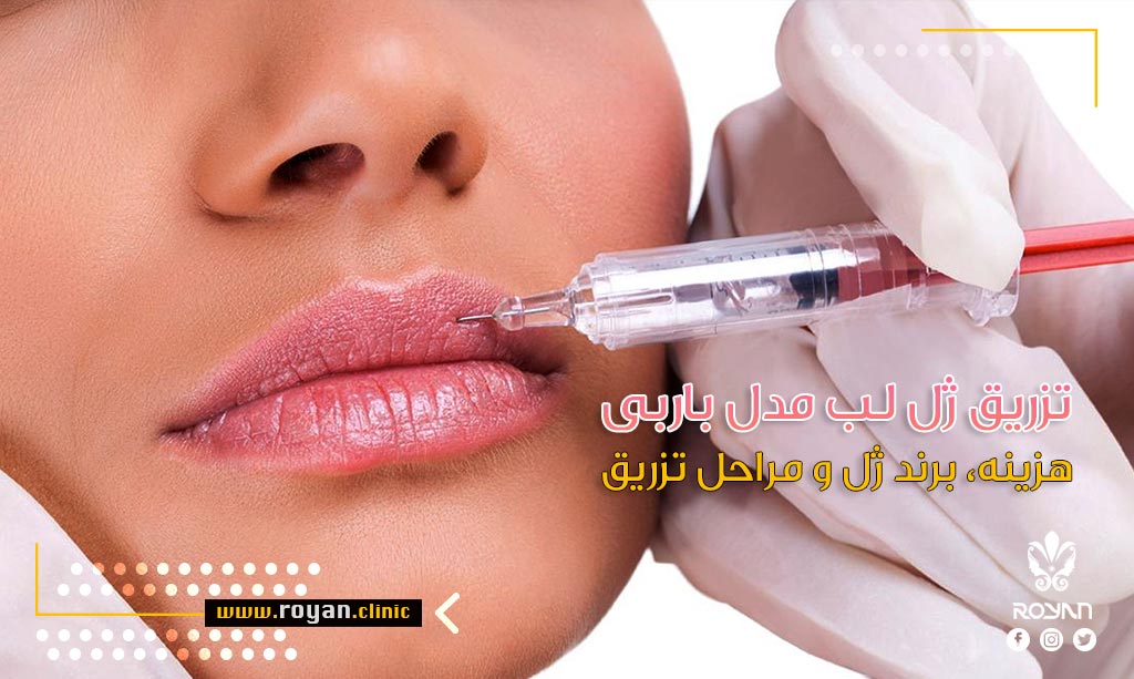 ژل لب مدل باربی