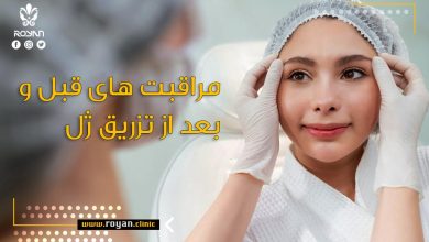 مراقبت های تزریق ژل