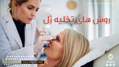 روش های تخلیه ژل