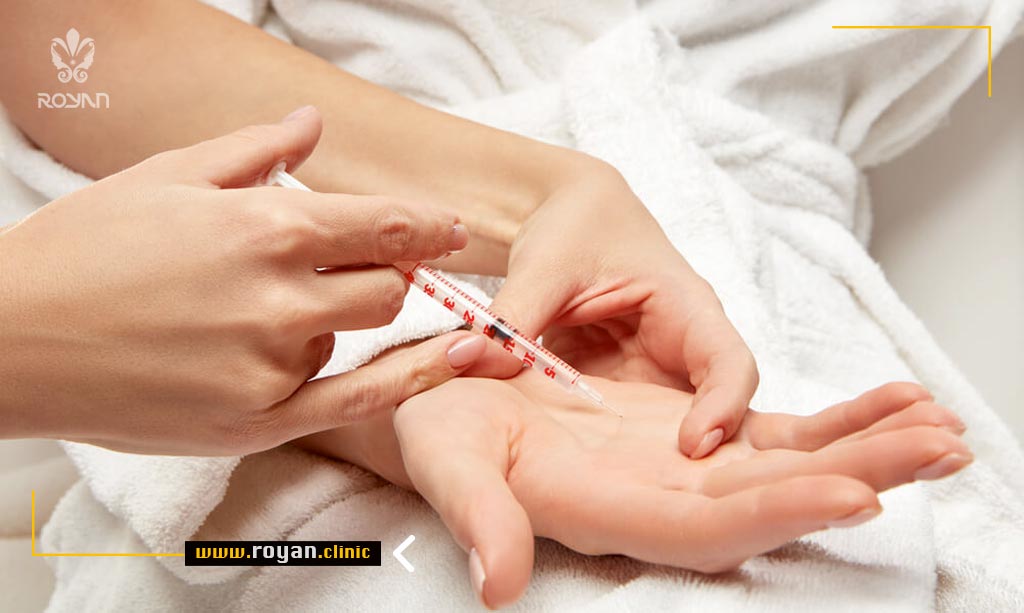 تزریق بوتاکس کف دست